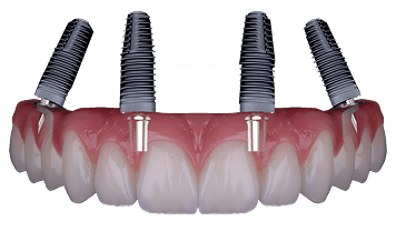 Cirurgia Oral e Implantologia